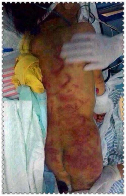 最新爆料母亲虐童案,揭开家庭暴力背后的黑暗面